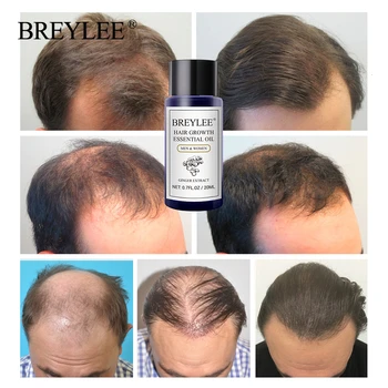 BREYLEE Plaukų Augimą eterinis Aliejus Greitai Galingas Plaukų Esmė Anti Plaukų Slinkimas Serumas Andrea Maitinamasis Plaukų Priežiūros Gydymo Produktus