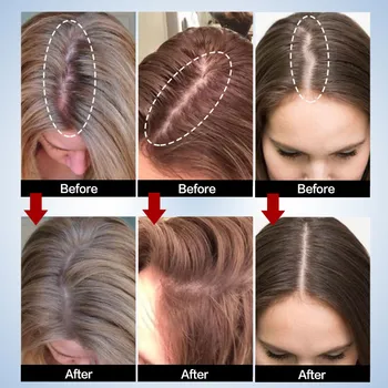 Veiksmingos Plaukų Augimo Serumas Esmė Moterų ir Vyrų Stabdžių užkirsti kelią Plaukų Slinkimas, alopecija Skysčio Pažeistų Plaukų Remonto Sparčiai Auga